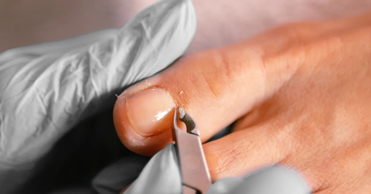 Saúde das Unhas - O Que Elas Revelam Sobre Seu Corpo